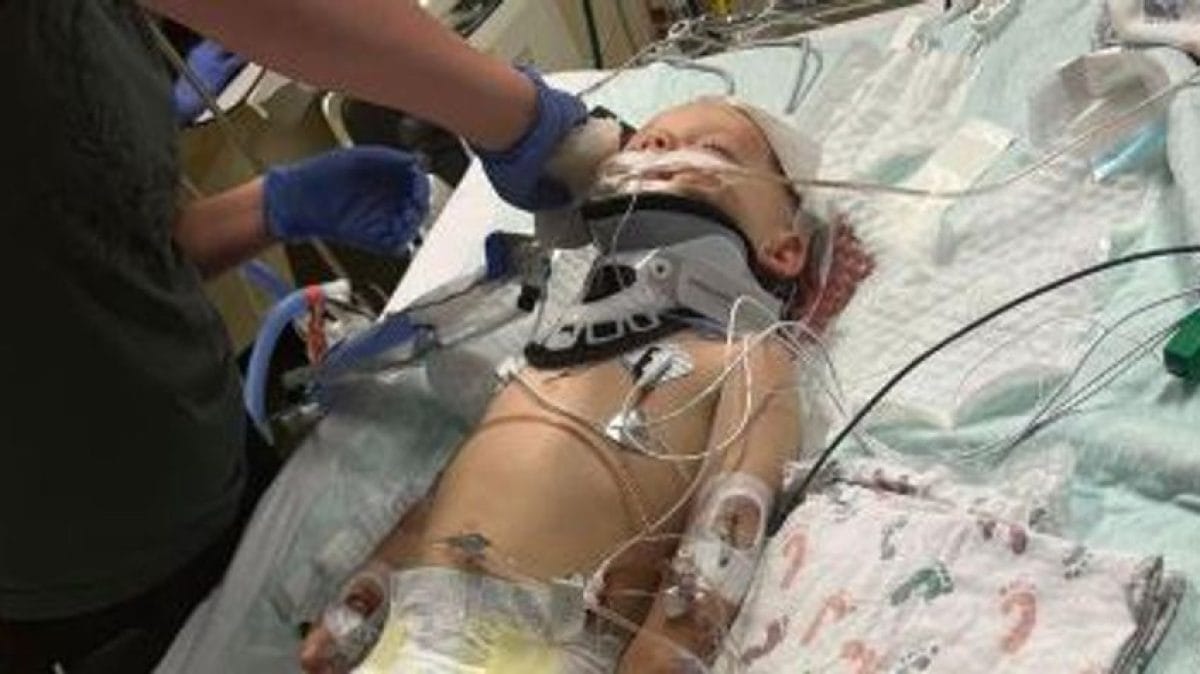 Az orvosok hősies küzdelme: egy véletlen balesetben a dada keze veszélyezteti a kétéves kisfiú életét
