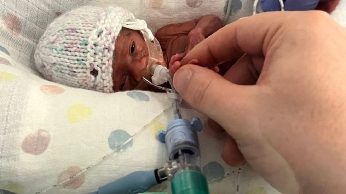 Egy csoda baba harca az életért: 102 nap az inkubátorban, de most végre hazamehetett