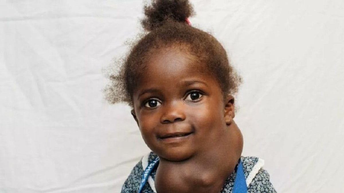 Az álmából ébresztette a halál – Egy 3 éves kislány élete a fejméretű tumor miatti fojtogatásban