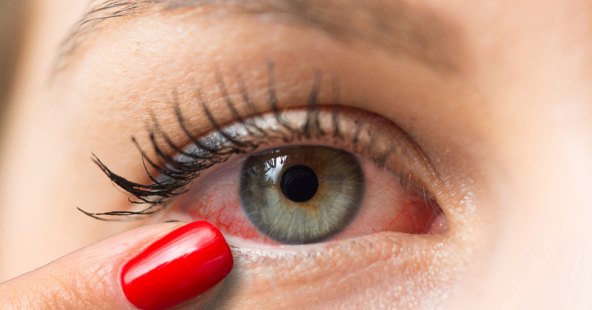 A nátha árnyékában: hogyan befolyásolja a közönséges megfázás a szem egészségét