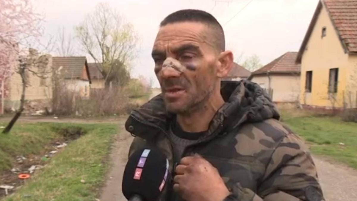 Brutális erőszak Jászkarajenőn: Egy férfi szerint kalapáccsal püfölték és fogait harapófogóval tépték ki - Videó