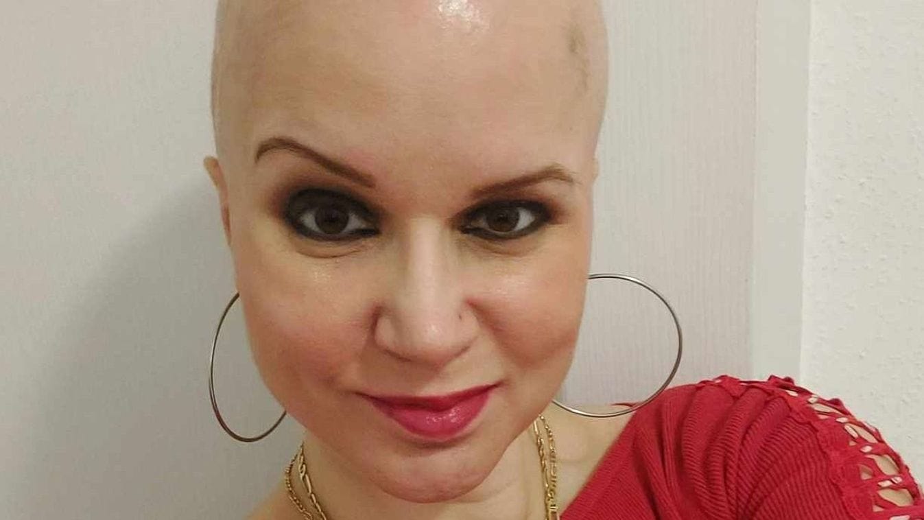 Újrakezdés a küzdelemben: Niki elhatározta, hogy legyőzi a rákot két agyvérzés után