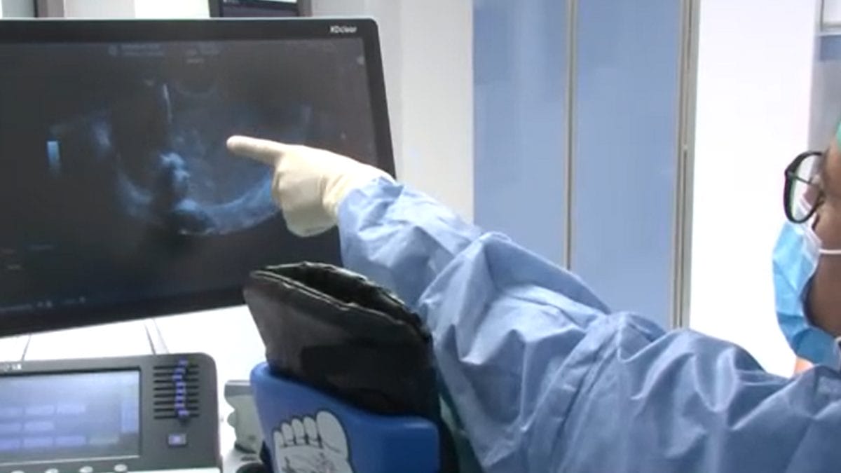 Az "Életmentő orvosi csoda: Altatás nélkül végzett magzati műtét a Semmelweis Egyetem klinikáján - videó