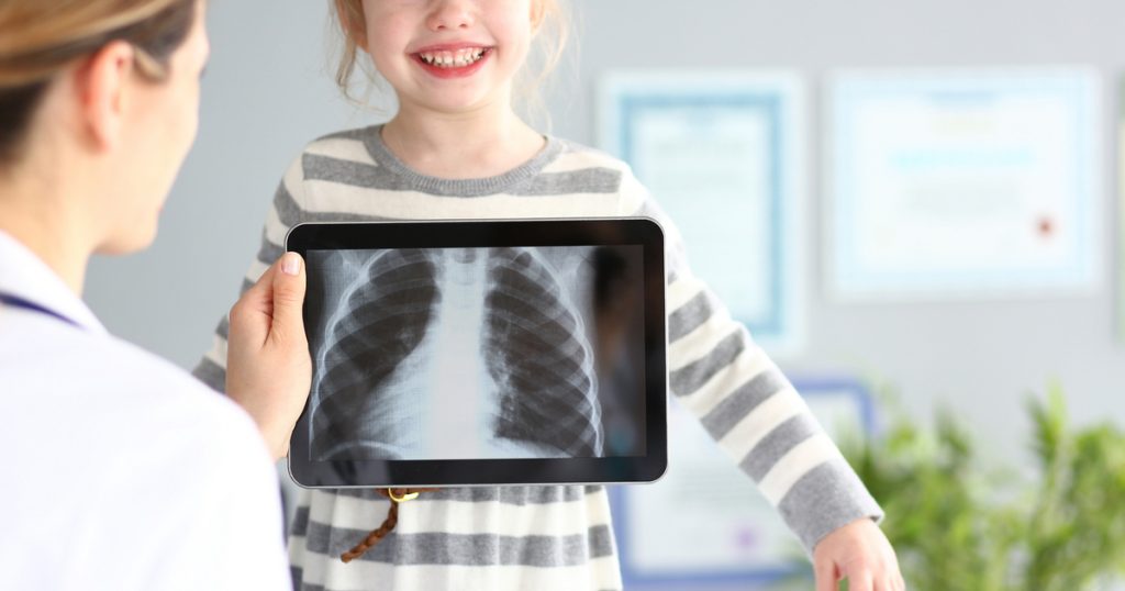 A röntgenorvos lenyűgöző felfedezése: 5 különleges tárgy a gyerekek gyomrában