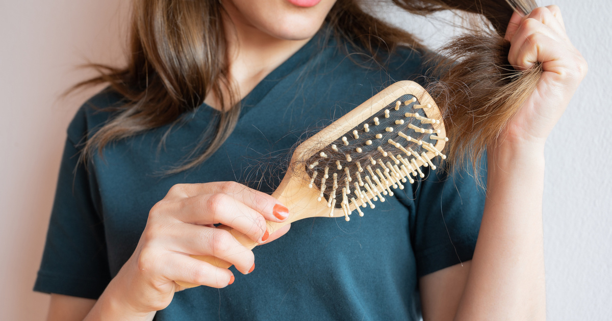 A hajhullást okozó 7 gyakori egészségügyi probléma és hogyan lehet ezek ellenére tenni