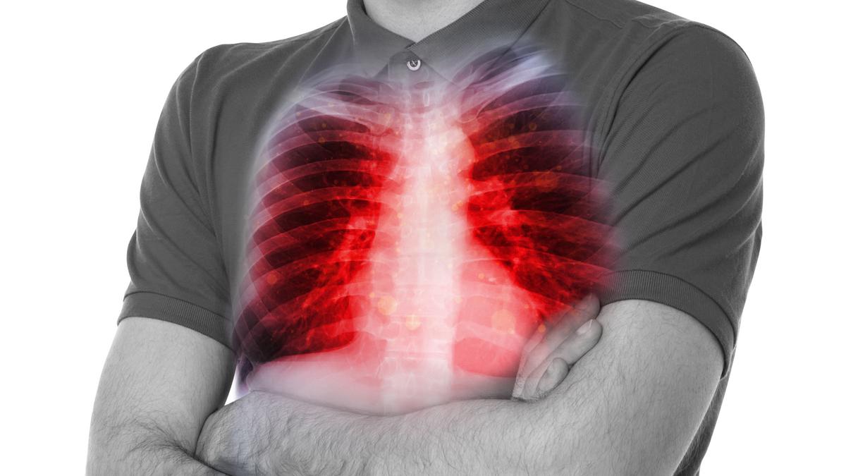 A tüdőrák kockázata csökken a korral: új kutatás eredményei