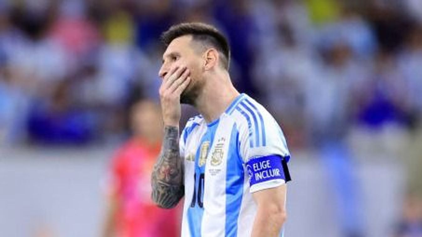 A Messi árnyékában: Égett Messi, vigasztalták a rajongói
