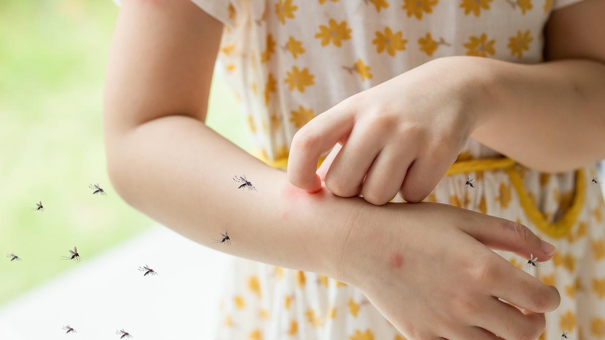 Ismerje fel és óvja meg magát: az életveszélyes rovarcsípések allergiás reakciói