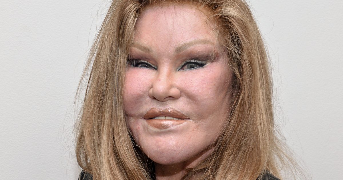 Visszatekintés a múltba: Jocelyn Wildenstein fiatalkori fotóját osztotta meg a közösségi médiában