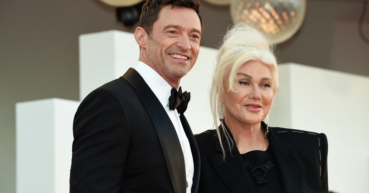 Hugh Jackman kapcsolatának állapota: A válás megviselte 13 évvel idősebb exfeleségével