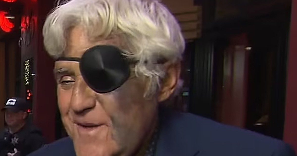 Az “Ikonszintű sztár súlyos sérülése: Jay Leno félszemű a baleset után” című cikkhez passzolna.