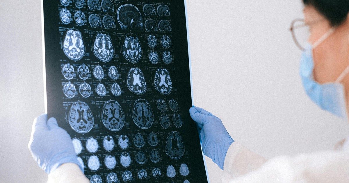 Az Alzheimer- és Parkinson-kórban rejtőző titok megfejtése: A tudósok áttörést értek el a kutatásban